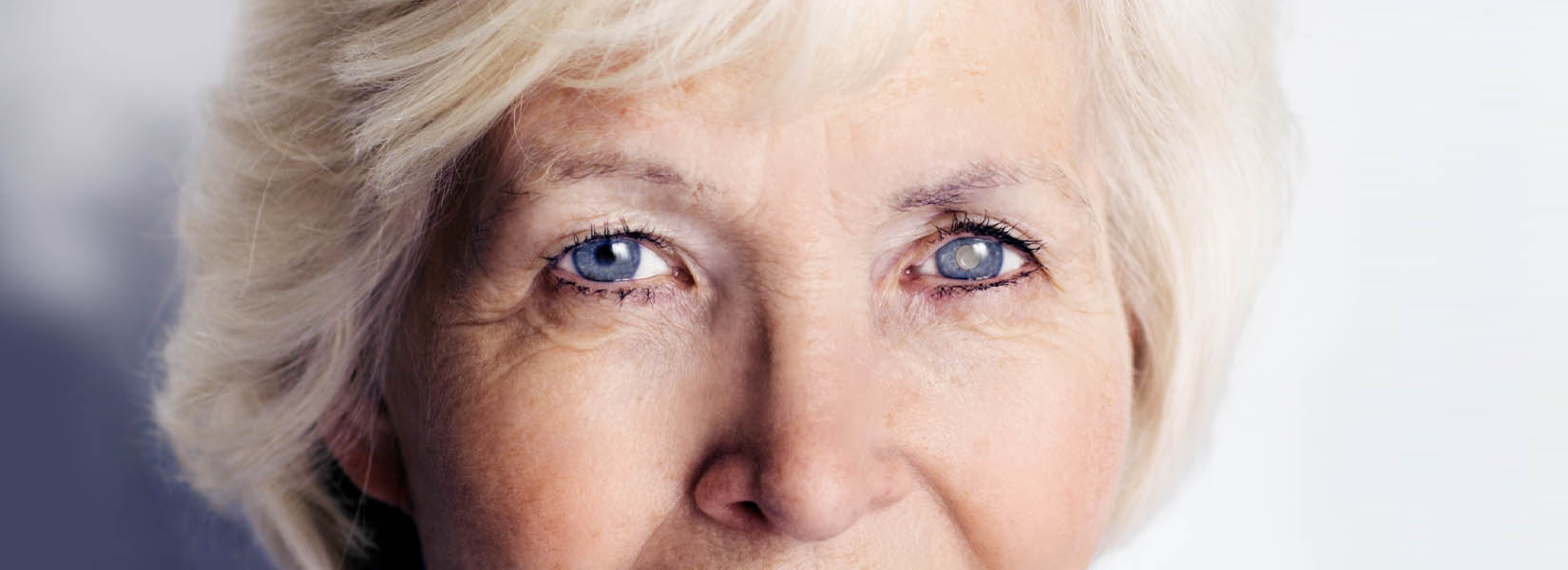 Cataract Surgery in Pagosa Springs